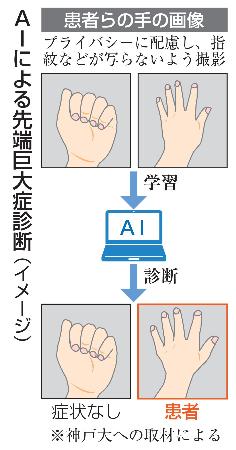 <p>　ＡＩによる先端巨大症診断（イメージ）</p>